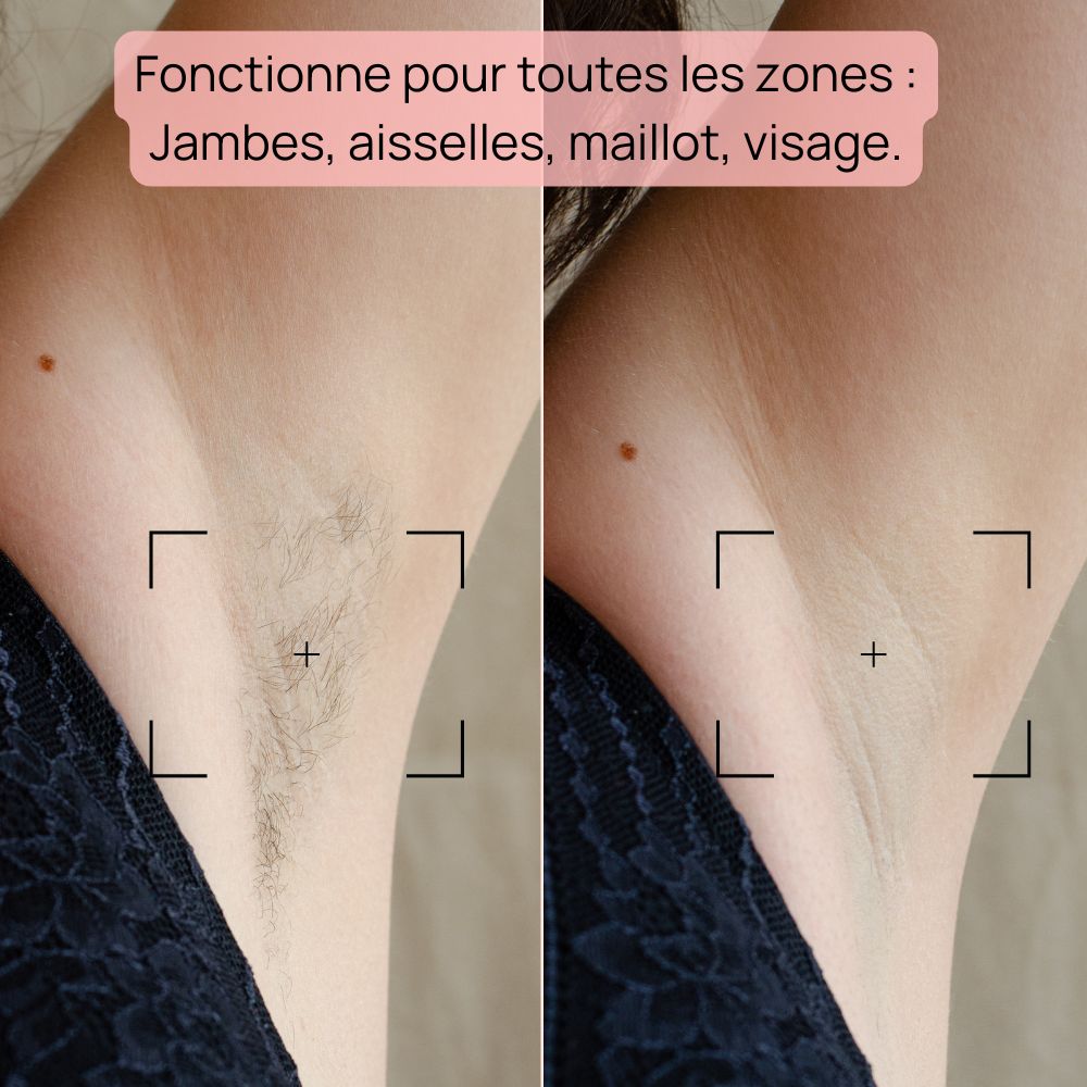 epilateur-lumiere-pulsee-resultats-aisselles.jpg